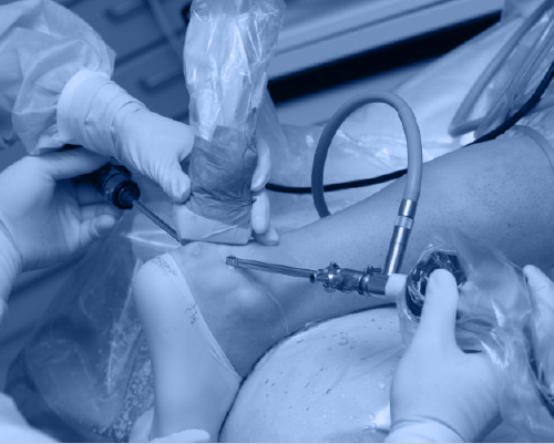 Ayak Bileği Artroskopisi