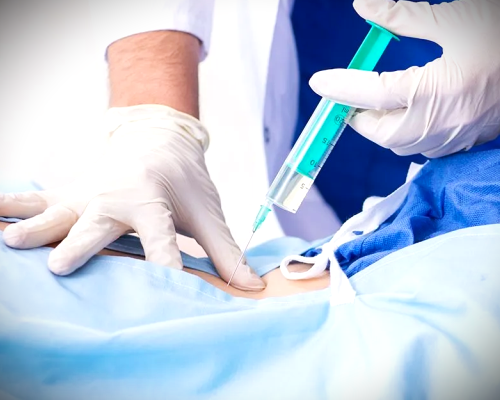 Bel ve Boyun Ağrıları İçin Enjeksiyon Nasıl Yapılır ?