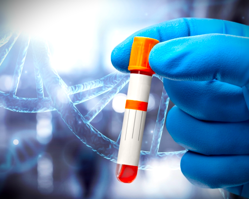 Kök Hücre (SVF – Stromal Vasküler Fraksiyon) Uygulamaları