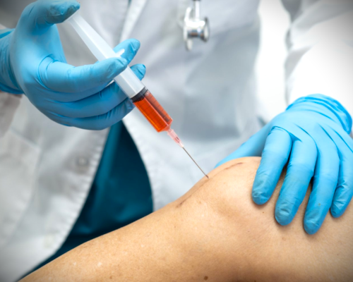 PRP Uygulaması Nasıl Yapılır ?